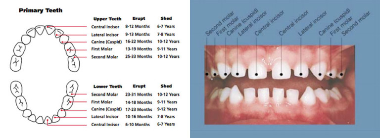 tooth-eruption-in-primary-teeth-dr-dunne-eugene-dentist-pediatric